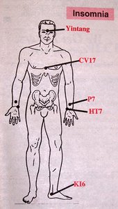 Insomnia Diagram - Copyright – Stock Photo / Register Mark