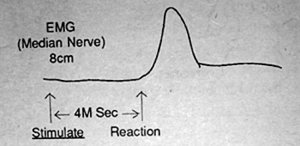 Diagram 1 - Copyright – Stock Photo / Register Mark