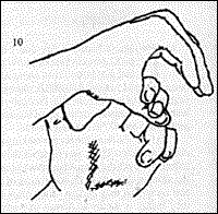 Figure 10 - Copyright – Stock Photo / Register Mark