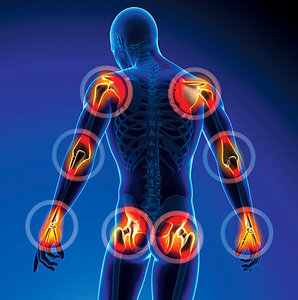 neuropathies - Copyright – Stock Photo / Register Mark