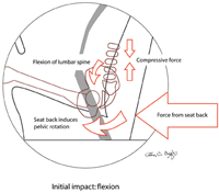 The Biomechanics of Spondylolysis, Part 1 - Copyright – Stock Photo / Register Mark