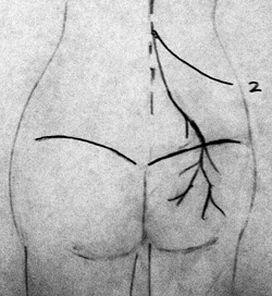 cluneal nerves - Copyright – Stock Photo / Register Mark
