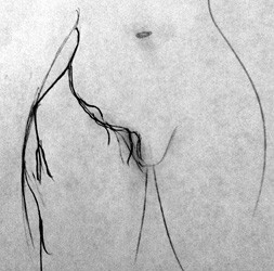 lateral femoral cutaneous nerves - Copyright – Stock Photo / Register Mark