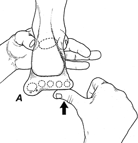 plantarflexed - Copyright – Stock Photo / Register Mark