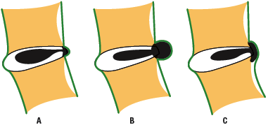 Protrusion, Extrusion, Extrusion - Copyright – Stock Photo / Register Mark