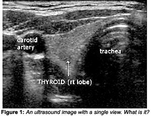 image - Copyright – Stock Photo / Register Mark